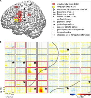 A Study of Word Complexity Under Conditions of Non-experimental, Natural Overt Speech Production Using ECoG